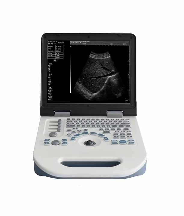 Ultrasound